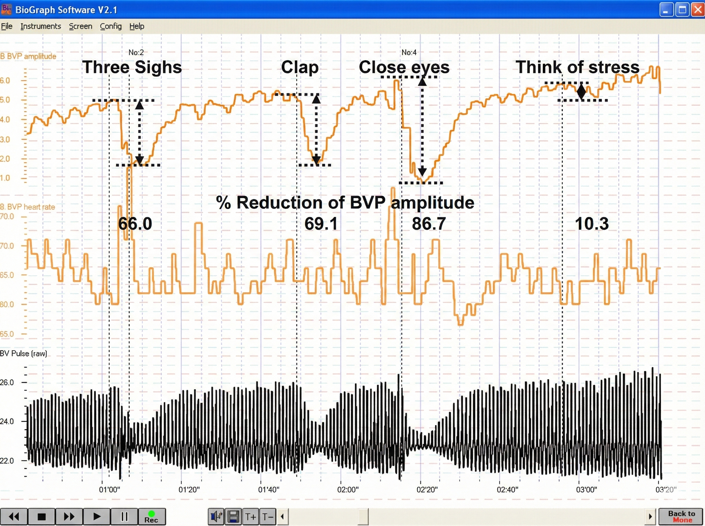 BVP responses to psychological stimuli